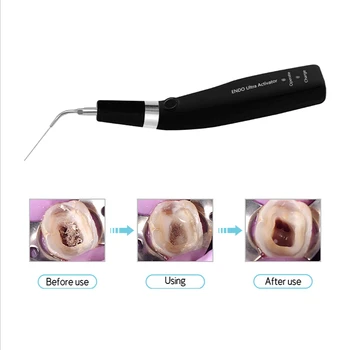 Zubné Endo Ultra Activator Endo Irigátor Bezdrôtový Ultrazvukové Aktivátor S 6 Tipov 40-50Khz 1500mAh Pre Endodontic Liečba